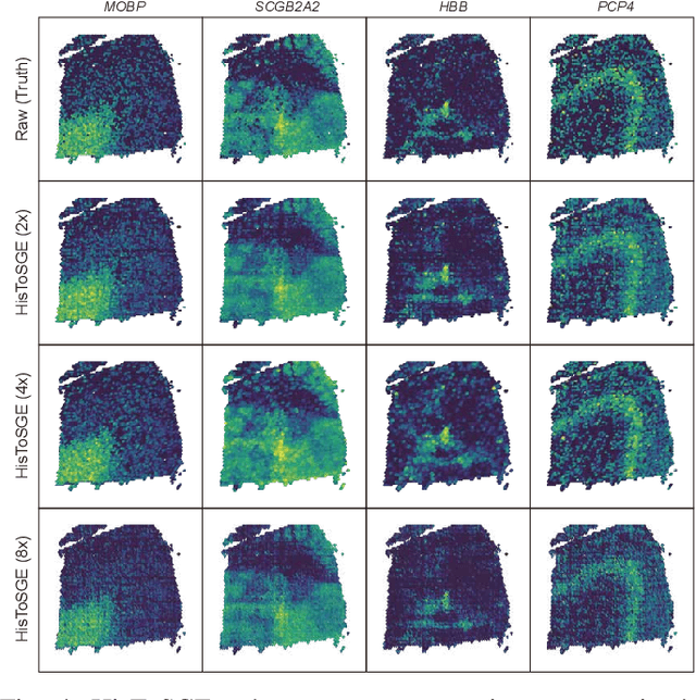 Figure 4 for High-Resolution Spatial Transcriptomics from Histology Images using HisToSGE