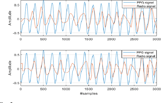 Figure 2 for Non-Contact Acquisition of PPG Signal using Chest Movement-Modulated Radio Signals