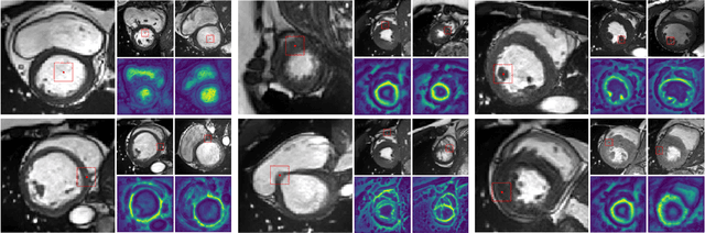 Figure 3 for Dense Self-Supervised Learning for Medical Image Segmentation