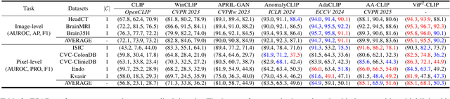 Figure 4 for ViP$^2$-CLIP: Visual-Perception Prompting with Unified Alignment for Zero-Shot Anomaly Detection