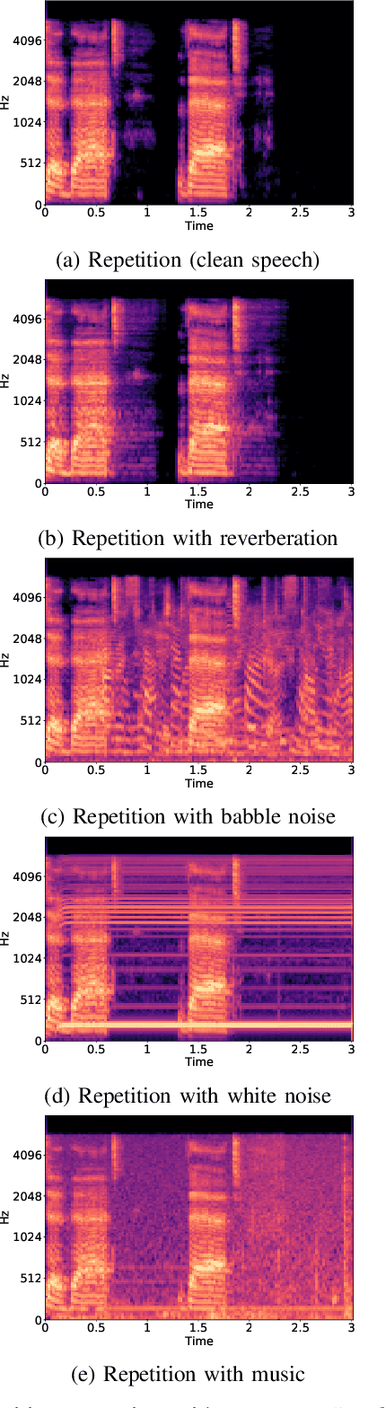 Figure 2 for Advancing Stuttering Detection via Data Augmentation, Class-Balanced Loss and Multi-Contextual Deep Learning