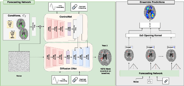 Figure 1 for Spatio-Temporal Conditional Diffusion Models for Forecasting Future Multiple Sclerosis Lesion Masks Conditioned on Treatments