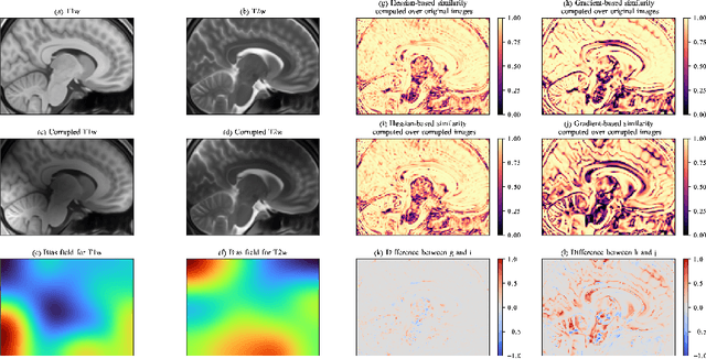 Figure 3 for Hessian-based Similarity Metric for Multimodal Medical Image Registration