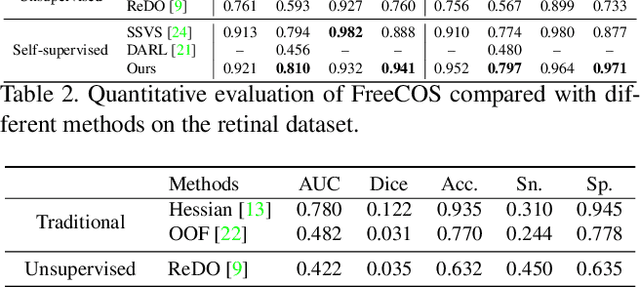 Figure 4 for FreeCOS: Self-Supervised Learning from Fractals and Unlabeled Images for Curvilinear Object Segmentation