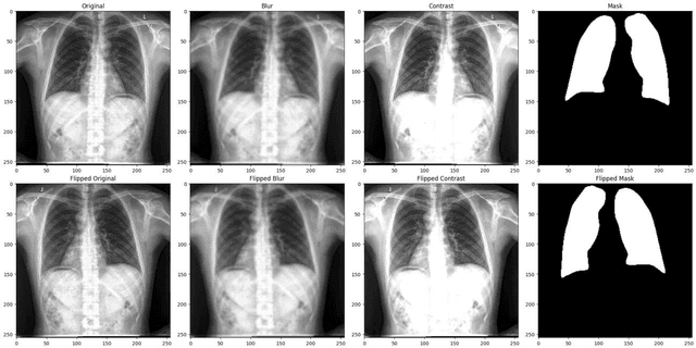 Figure 3 for Hierarchical SegNet with Channel and Context Attention for Accurate Lung Segmentation in Chest X-ray Images