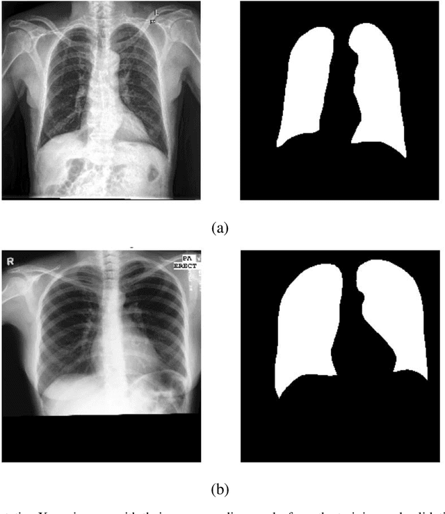 Figure 1 for Hierarchical SegNet with Channel and Context Attention for Accurate Lung Segmentation in Chest X-ray Images
