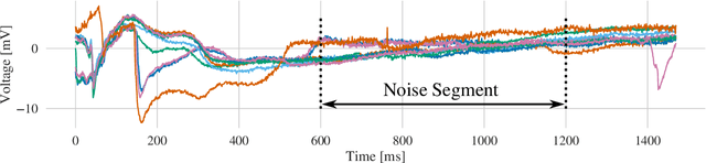 Figure 4 for Estimating Cardiac Tissue Conductivity from Electrograms with Fully Convolutional Networks