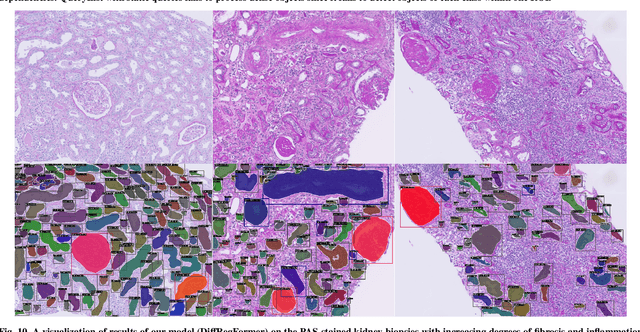 Figure 3 for Advances in Kidney Biopsy Structural Assessment through Dense Instance Segmentation