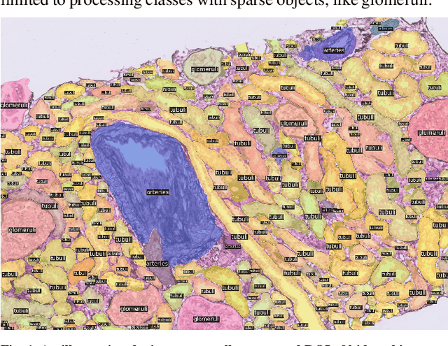Figure 1 for Advances in Kidney Biopsy Structural Assessment through Dense Instance Segmentation