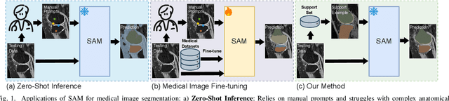 Figure 1 for Few-Shot Adaptation of Training-Free Foundation Model for 3D Medical Image Segmentation