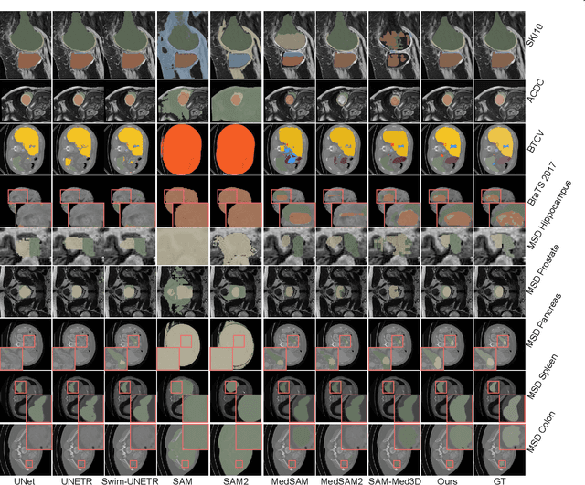 Figure 4 for Few-Shot Adaptation of Training-Free Foundation Model for 3D Medical Image Segmentation