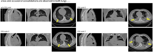Figure 4 for Radiology Report Conditional 3D CT Generation with Multi Encoder Latent diffusion Model