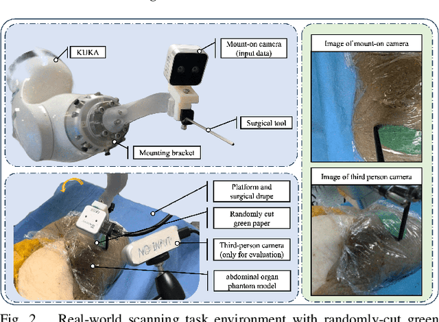 Figure 2 for Memorized action chunking with Transformers: Imitation learning for vision-based tissue surface scanning