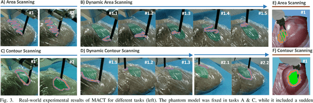 Figure 3 for Memorized action chunking with Transformers: Imitation learning for vision-based tissue surface scanning