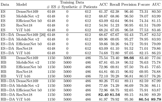 Figure 2 for Generative Diffusion Model Bootstraps Zero-shot Classification of Fetal Ultrasound Images In Underrepresented African Populations