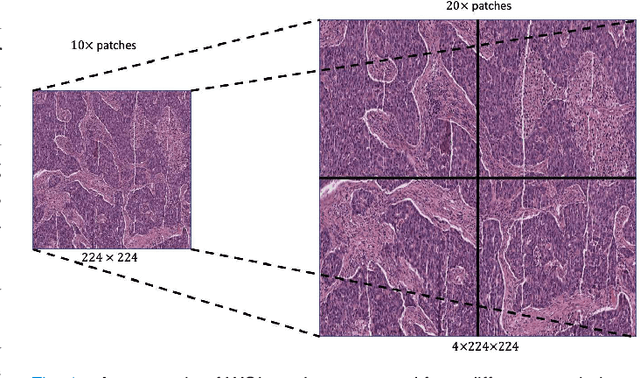Figure 1 for A Dual-branch Self-supervised Representation Learning Framework for Tumour Segmentation in Whole Slide Images