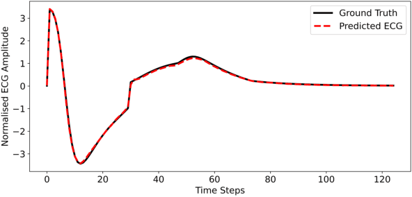 Figure 2 for Towards Deep Learning Surrogate for the Forward Problem in Electrocardiology: A Scalable Alternative to Physics-Based Models