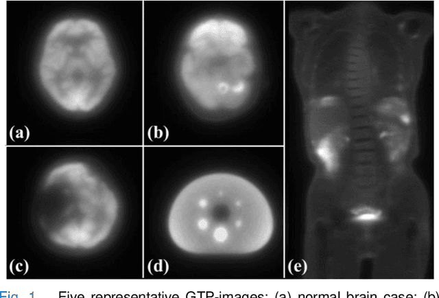 Figure 1 for Physics-Constrained Diffusion Reconstruction with Posterior Correction for Quantitative and Fast PET Imaging