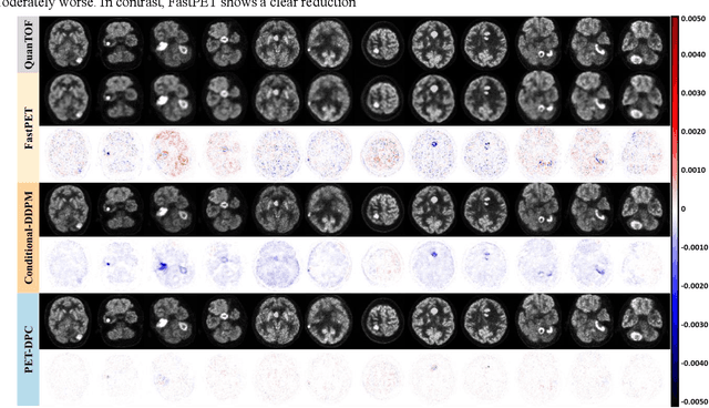 Figure 2 for Physics-Constrained Diffusion Reconstruction with Posterior Correction for Quantitative and Fast PET Imaging