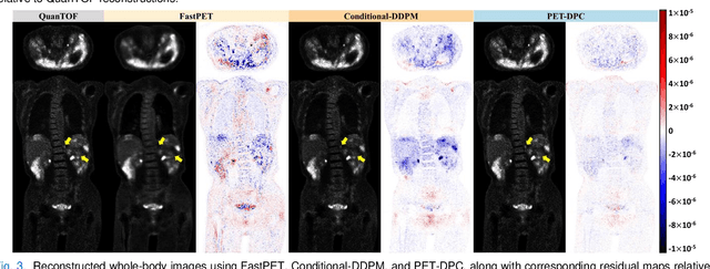 Figure 3 for Physics-Constrained Diffusion Reconstruction with Posterior Correction for Quantitative and Fast PET Imaging