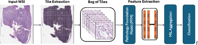 Figure 1 for Single GPU Task Adaptation of Pathology Foundation Models for Whole Slide Image Analysis