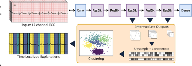Figure 1 for Explaining deep learning for ECG using time-localized clusters