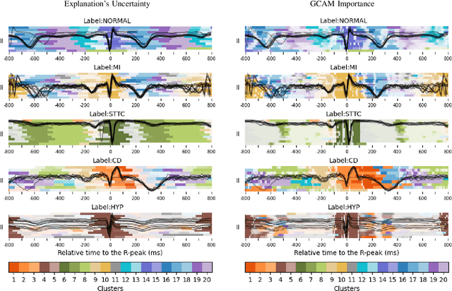 Figure 3 for Explaining deep learning for ECG using time-localized clusters