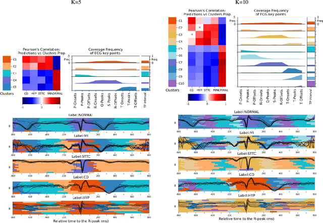 Figure 4 for Explaining deep learning for ECG using time-localized clusters