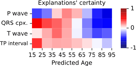 Figure 2 for Explaining deep learning for ECG using time-localized clusters