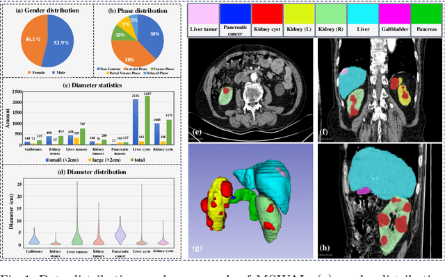 Figure 1 for MSWAL: 3D Multi-class Segmentation of Whole Abdominal Lesions Dataset