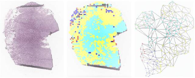 Figure 1 for Histopathology Whole Slide Image Analysis with Heterogeneous Graph Representation Learning