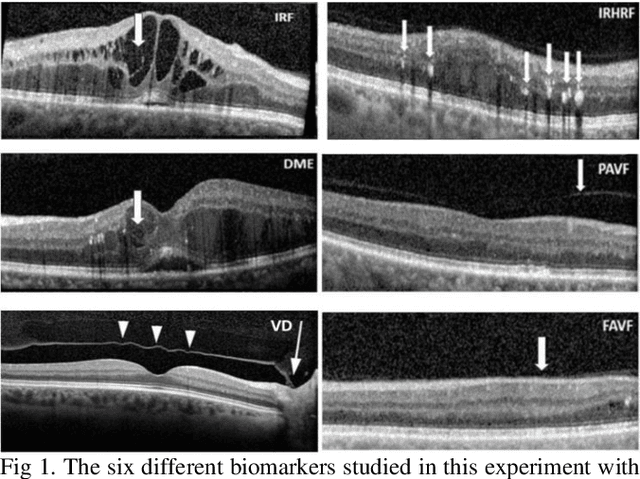 Figure 1 for Ophthalmic Biomarker Detection with Parallel Prediction of Transformer and Convolutional Architecture