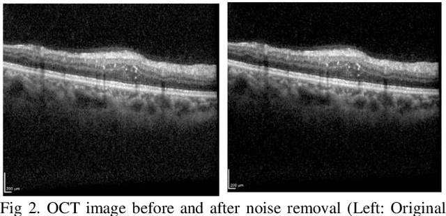 Figure 2 for Ophthalmic Biomarker Detection with Parallel Prediction of Transformer and Convolutional Architecture
