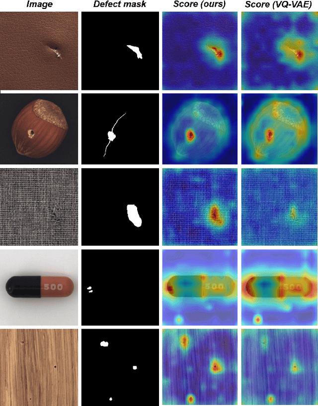 Figure 4 for Patch-aware Vector Quantized Codebook Learning for Unsupervised Visual Defect Detection