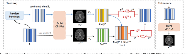 Figure 1 for Re-Visible Dual-Domain Self-Supervised Deep Unfolding Network for MRI Reconstruction