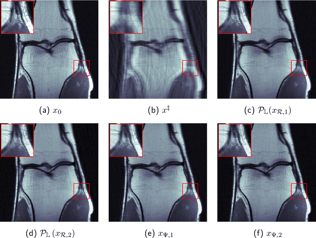 Figure 3 for Uncertainty-Aware Null Space Networks for Data-Consistent Image Reconstruction
