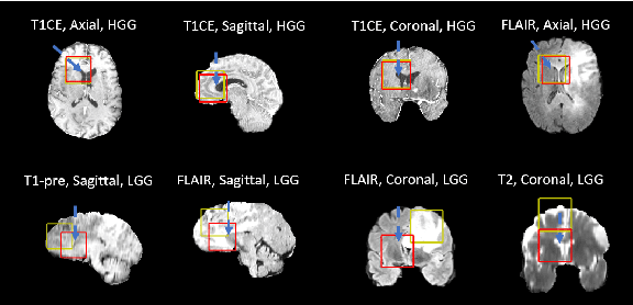 Figure 3 for Asynchronous Decentralized Federated Lifelong Learning for Landmark Localization in Medical Imaging