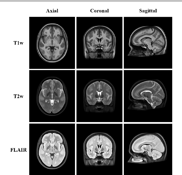 Figure 3 for A Bibliography of Multiple Sclerosis Lesions Detection Methods using Brain MRIs