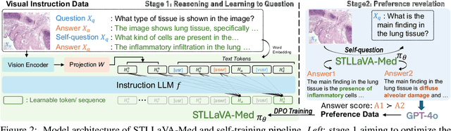 Figure 3 for STLLaVA-Med: Self-Training Large Language and Vision Assistant for Medical