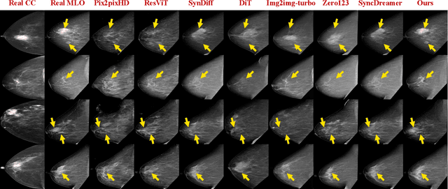 Figure 3 for Bidirectional Mammogram View Translation with Column-Aware and Implicit 3D Conditional Diffusion