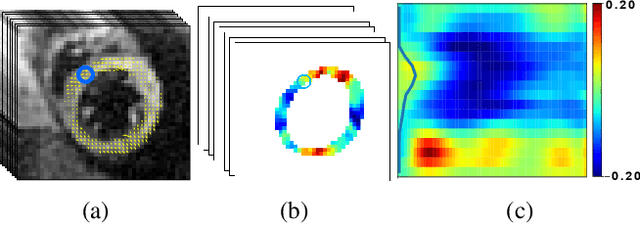 Figure 2 for Multimodal Learning To Improve Cardiac Late Mechanical Activation Detection From Cine MR Images