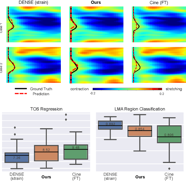 Figure 3 for Multimodal Learning To Improve Cardiac Late Mechanical Activation Detection From Cine MR Images