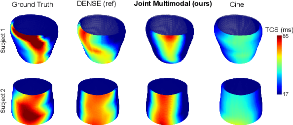 Figure 4 for Multimodal Learning To Improve Cardiac Late Mechanical Activation Detection From Cine MR Images