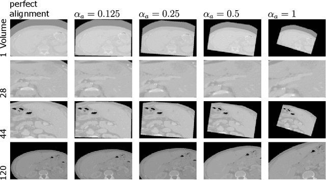 Figure 3 for Enhancing Synthetic CT from CBCT via Multimodal Fusion: A Study on the Impact of CBCT Quality and Alignment