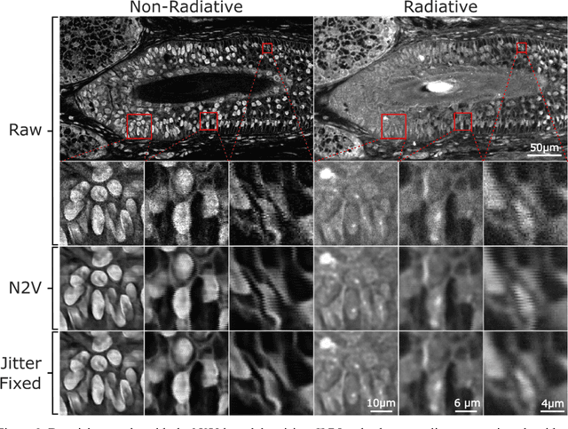 Figure 2 for Virtual Histology with Photon Absorption Remote Sensing using a Cycle-Consistent Generative Adversarial Network with Weakly Registered Pairs
