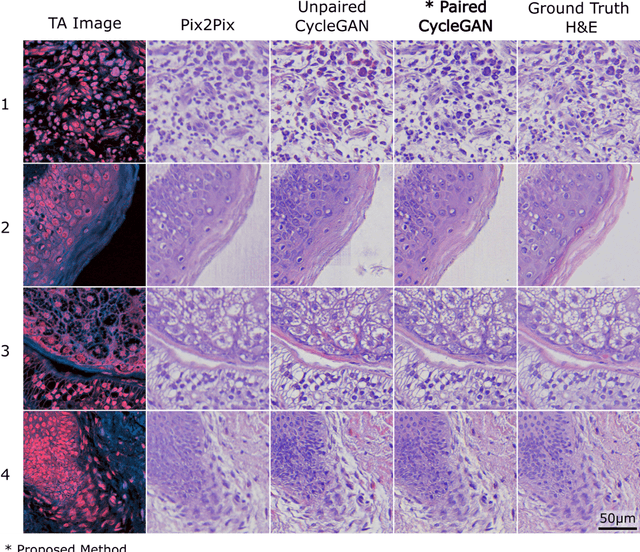 Figure 3 for Virtual Histology with Photon Absorption Remote Sensing using a Cycle-Consistent Generative Adversarial Network with Weakly Registered Pairs