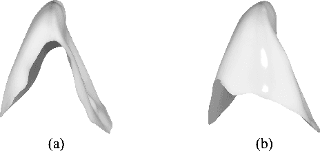 Figure 3 for Automatic Tooth Arrangement with Joint Features of Point and Mesh Representations via Diffusion Probabilistic Models