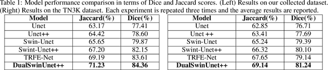 Figure 2 for E2E-Swin-Unet++: An Enhanced End-to-End Swin-Unet Architecture With Dual Decoders For PTMC Segmentation