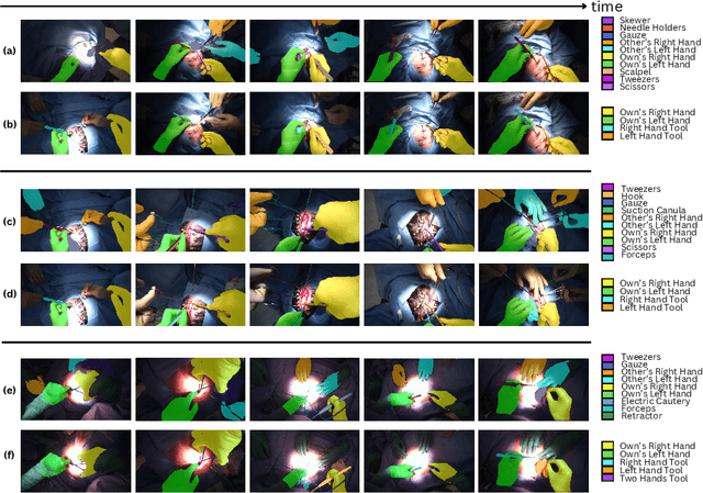 Figure 2 for EgoSurgery-HTS: A Dataset for Egocentric Hand-Tool Segmentation in Open Surgery Videos