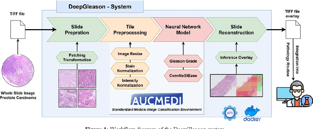 Figure 1 for DeepGleason: a System for Automated Gleason Grading of Prostate Cancer using Deep Neural Networks